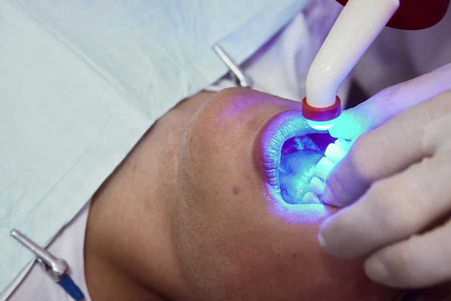 Sbiancamento denti professionale in studio — Studio Dentistico Dott. Filippo Merli