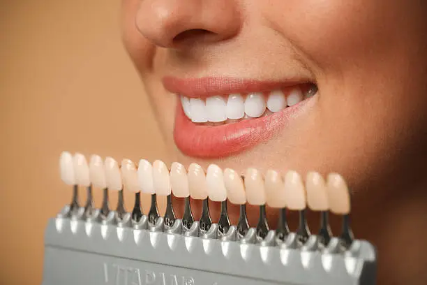 Sorriso perfetto con trattamenti di estetica dentale — Studio Dentistico Dott. Filippo Merli